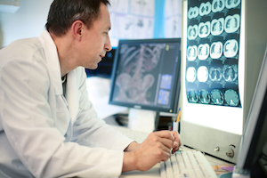 Medical Doctor looking at brain screen